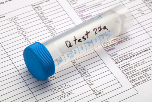 We respond to frequently asked questions about our water filtration system